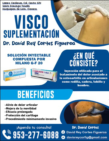 Aplicación de visco suplementación